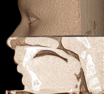 dvt-kfo-27.jpg